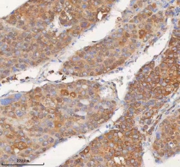 Anti-SHKBP1 / SH3KBP1-binding protein 1 / SETA-binding protein 1 / SB1