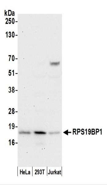 Anti-RPS19BP1/AROS