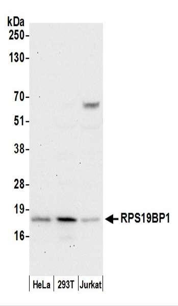 Anti-RPS19BP1/AROS