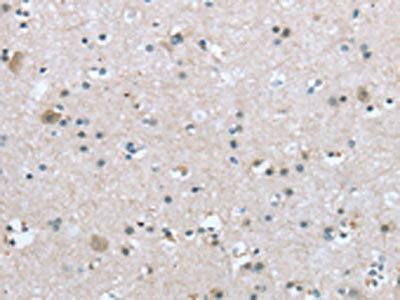 Anti-TRPM3