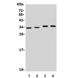 Anti-Neurotrophin 3 / NTF3