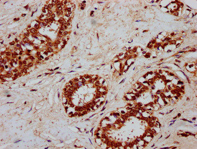 Anti-CSN3