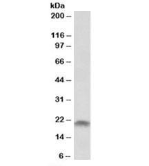 Anti-SPINT2