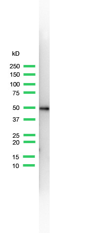Anti-Keratin 14, clone SP53