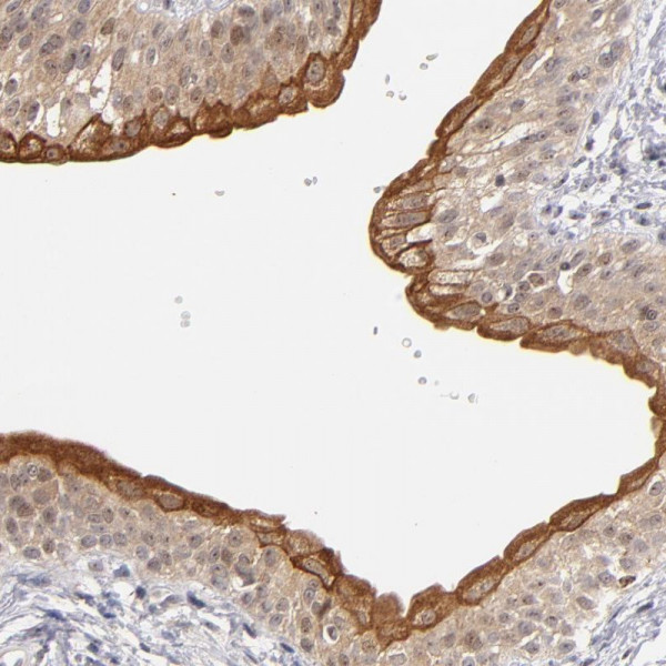 Anti-PCNX4