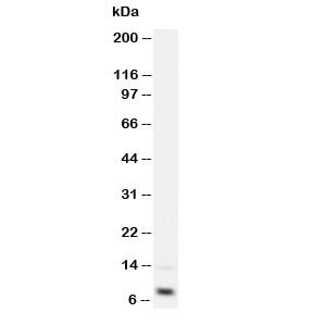 Anti-IGF-1