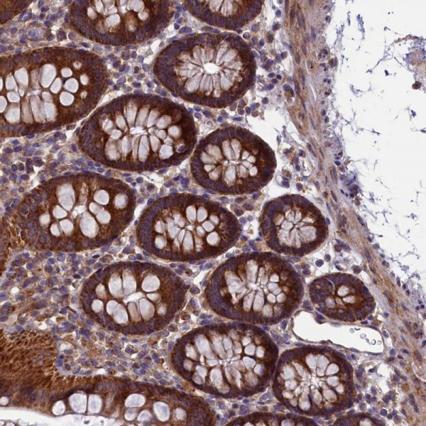 Anti-ACAD8
