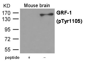 Anti-Phospho-ARHGAP35 (Tyr1105)