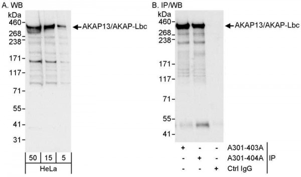 Anti-AKAP13/AKAP-Lbc