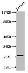 Anti-Cleaved-COL4A3 (P1426)