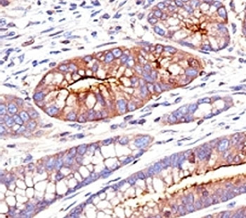 Anti-CEA / Carcinoembryonic Antigen, clone SPM551
