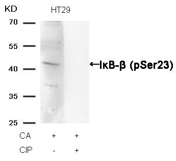 Anti-phospho-IKB beta (Ser23)