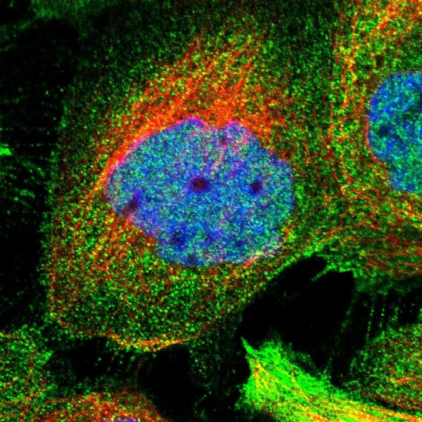 Anti-ZNF20
