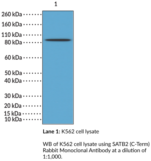 Anti-SATB2 (C-Term) Rabbit Monoclonal Antibody (Clone RM365)