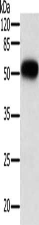 Anti-TNFRSF10B