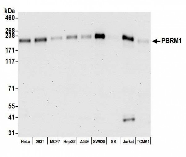 Anti-PBRM1 Recombinant Monoclonal