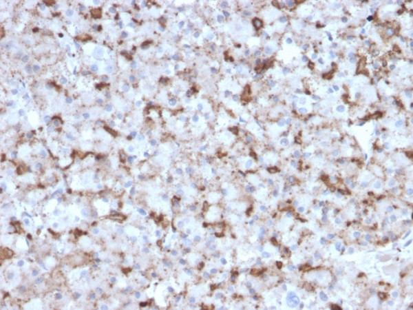 Anti-Prolactin (Pituitary Tumor Marker)(PRL/2643), CF640R conjugate, 0.1mg/mL