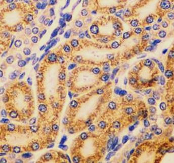 Anti-ALDH1A2