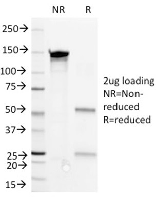 Anti-CD36 (Platelet &amp; Microvessel Marker), clone 1.00E+08