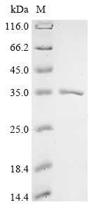 Aspartate carbamoyltransferase (pyrB), Escherichia coli O45:K1, recombinant