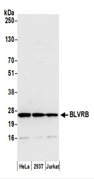 Anti-BLVRB/Biliverdin reductase B