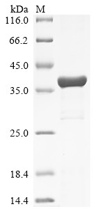 Nuclear RNA export factor 2 (nxf2), partial, Drosophila melanogaster, recombinant
