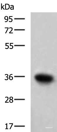 Anti-TNNT1