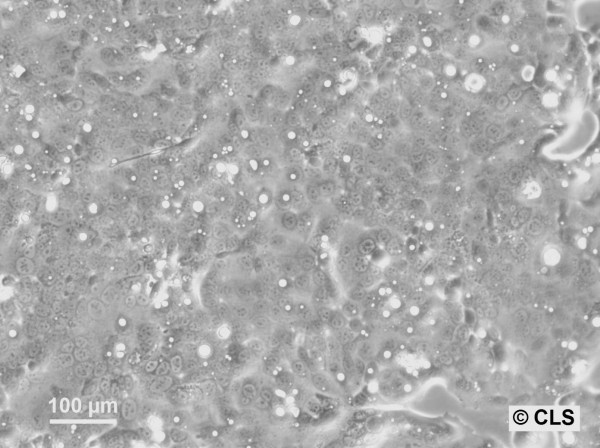 HROC60 Cells