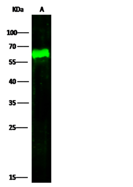Anti-Arylsulfatase A/ARSA Monoclonal Recombinant Antibody