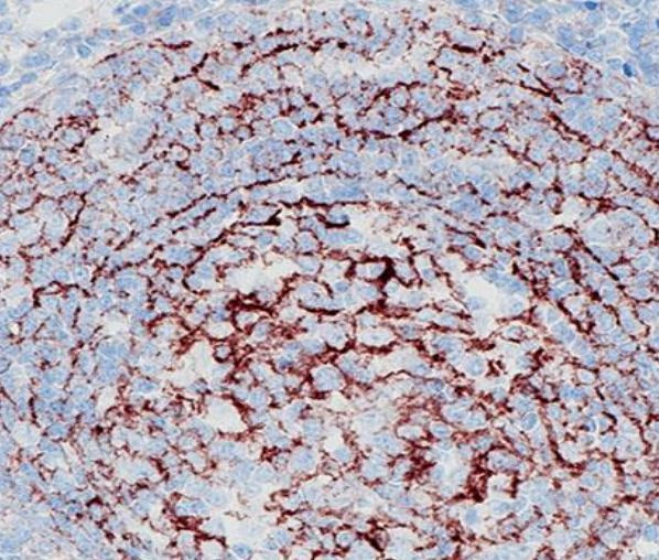 Anti-CD35 / CR1, clone SQab19151