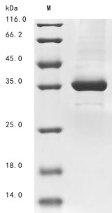 Super small secreted glycoprotein (GP), Zaire ebolavirus, recombinant