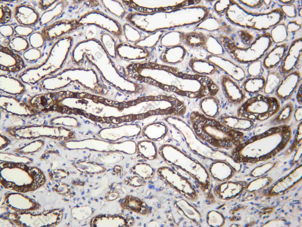 Anti-Recombinant VATA, clone C112541