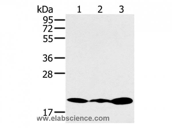 Anti-RNF5