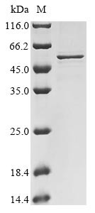 SARS coronavirus Nucleoprotein (N), human, recombinant