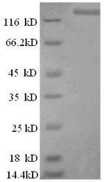 DNA ligase 1 (LIG1), human, recombinant