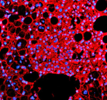 Anti-IHH / Indian hedgehog protein