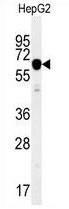 Anti-IGF2BP2