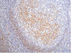 Anti-FCER2 Monoclonal