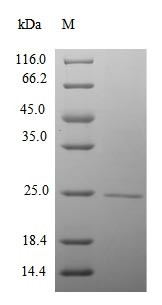 RNA polymerase II subunit A C-terminal domain phosphatase (Ctdp1), partial, mouse, recombinant
