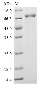 Interleukin-12 receptor subunit beta-2 (IL12RB2), partial, human, recombinant