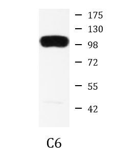 Anti-Hexokinase 1, clone 6B8-G11-E7