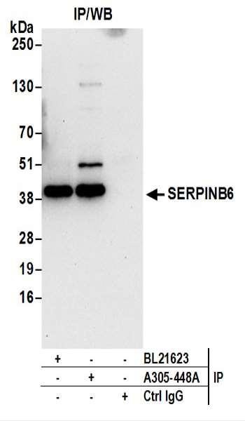 Anti-SERPINB6