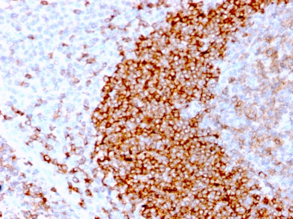 Anti-CD79b (B-Cell Marker), recombinant antibody, clone IGB/3170R