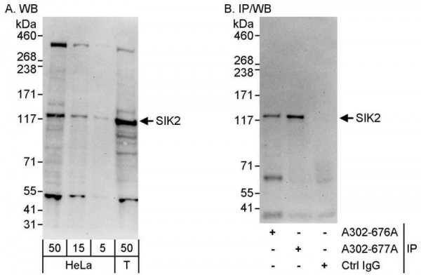 Anti-SIK2