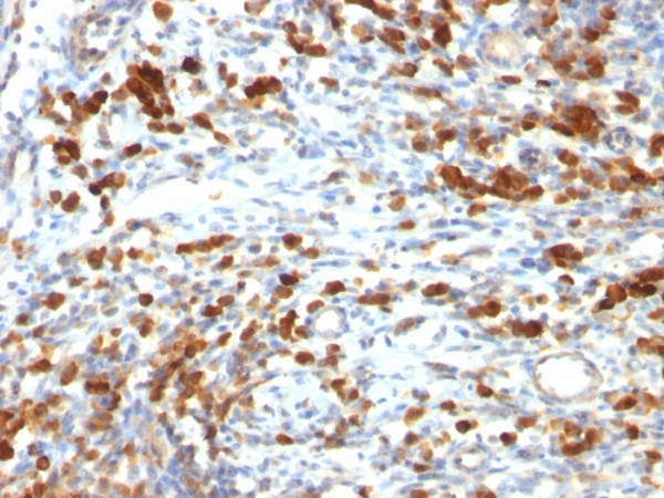 Anti-CD79a (B Cell Marker), clone IGA/764