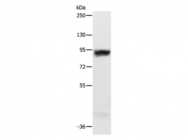 Anti-RRM1