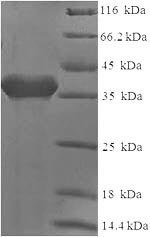 T-cell surface antigen CD2 (CD2), partial, human, recombinant
