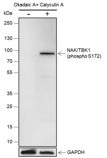 Anti-Recombinant Phospho-TBK1/NAK (Ser172), clone A843