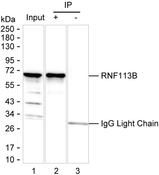 Anti-RNF113B