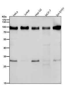 Anti-UBTF / UBF1 / Upstream binding factor 1, clone 32U20